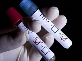 Процедура тестирования на ВИЧ-инфекцию